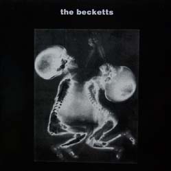 Becketts, The